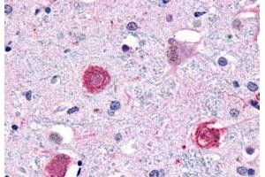Immunohistochemistry (Formalin/PFA-fixed paraffin-embedded sections) of human brain, neurons and glia with GPR1 polyclonal antibody . (G Protein-Coupled Receptor 1 antibody  (C-Term))