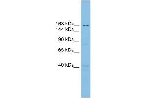 WB Suggested Anti-UBE2O Antibody Titration: 0.