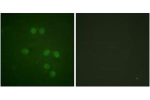 Immunofluorescence analysis of HepG2 cells, using HMG14 (Ab-21) Antibody.