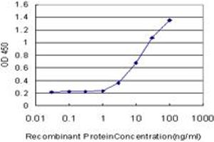 Detection limit for recombinant GST tagged NEFH is approximately 0. (NEFH antibody  (AA 263-363))