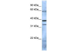 WB Suggested Anti-PCGF5 Antibody Titration:  0. (PCGF5 antibody  (N-Term))