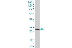 DTYMK polyclonal antibody (A01), Lot # 051017JC01 Western Blot analysis of DTYMK expression in HL-60 . (DTYMK antibody  (AA 103-212))