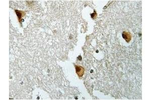 Image no. 1 for anti-Aldolase B, Fructose-Bisphosphate (ALDOB) antibody (ABIN317837) (ALDOB antibody)
