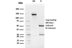 SDS-PAGE Analysis Purified Retinoblastoma (Rb1) Monoclonal Antibody (1F8). (Retinoblastoma 1 antibody)