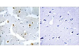 Peptide - +Immunohistochemistry analysis of paraffin-embedded human brain tissue using FMN2 antibody. (Formin 2 antibody  (Internal Region))
