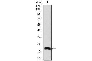 Western blot analysis using LRP5 mAb against human LRP5 (AA: 1422-1615) recombinant protein. (LRP5 antibody)