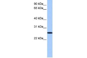 WB Suggested Anti-FBXO36 Antibody Titration: 0. (FBXO36 antibody  (N-Term))