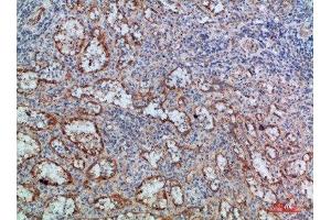 Immunohistochemical analysis of paraffin-embedded human-spleen, antibody was diluted at 1:200 (LTB antibody  (AA 41-90))