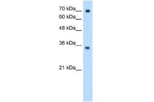 FCGRT antibody used at 0. (FcRn antibody  (N-Term))