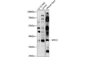 Western blot analysis of extracts of various cell lines, using SPRY2 antibody  at 1:1000 dilution. (SPRY2 antibody  (AA 1-100))