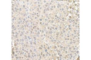 Immunohistochemistry (IHC) image for anti-RAN, Member RAS Oncogene Family (RAN) (AA 166-216) antibody (ABIN7455018) (RAN antibody  (AA 166-216))