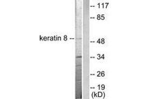 Western blot analysis of extracts from SKOV3 cells, using Keratin 8 Antibody. (KRT8 antibody  (AA 434-483))