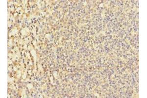 Immunohistochemistry of paraffin-embedded human tonsil tissue using ABIN7171457 at dilution of 1:100 (LY9 antibody  (AA 160-360))