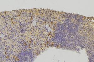 ABIN6278411 at 1/100 staining Human lymph node tissue by IHC-P.