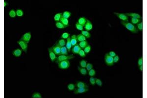 Immunofluorescence staining of PC-3 cells with ABIN7169503 at 1:166, counter-stained with DAPI.