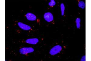 Proximity Ligation Analysis of protein-protein interactions between BIRC3 and CASP9. (BIRC3 antibody  (AA 1-604))