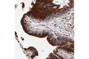 Immunohistochemical staining of human gallbladder with CKAP4 polyclonal antibody  shows distinct cytoplasmic positivity in glandular cells. (CKAP4 antibody  (AA 411-520))