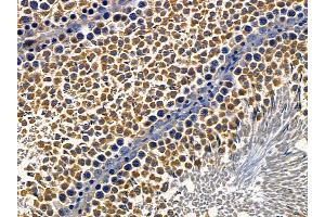 ABIN6257500 and ABIN6274303 at 1/100 staining rat testis tissue by IHC-P. (ST5 antibody  (Internal Region))