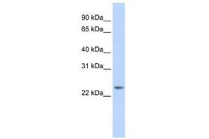 RAB8A antibody (70R-10557) used at 0. (RAB8A antibody  (Middle Region))