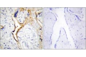 Immunohistochemistry analysis of paraffin-embedded human placenta tissue, using CKI-epsilon Antibody. (CK1 epsilon antibody  (AA 276-325))