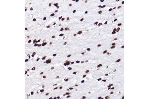 Immunohistochemistry of paraffin-embedded rat brain using MonoMethyl-Histone H3-K18 Rabbit mAb (ABIN7267683) at dilution of 1:100 (40x lens). (Histone 3 antibody  (H3K18me))