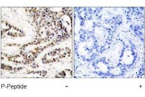 Image no. 1 for anti-cAMP Responsive Element Binding Protein 1 (CREB1) (pSer129) antibody (ABIN197039) (CREB1 antibody  (pSer129))
