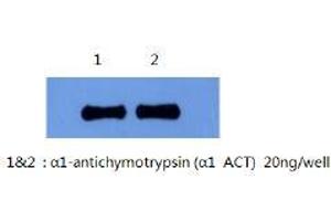 Western Blotting (WB) image for anti-serpin Peptidase Inhibitor, Clade A (Alpha-1 Antiproteinase, Antitrypsin), Member 3 (SERPINA3) antibody (ABIN1105305)