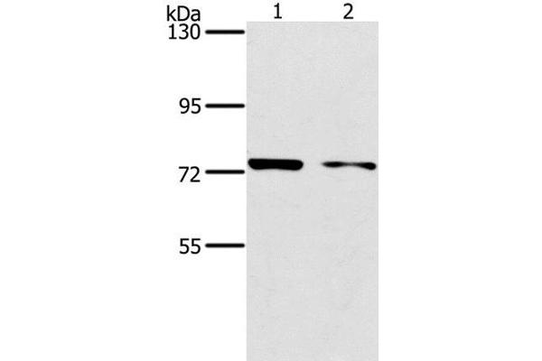 PPP1R13L antibody