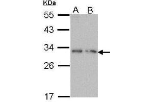 WB Image Sample (30 ug of whole cell lysate) A: Molt-4 , B: Raji 12% SDS PAGE antibody diluted at 1:1000 (PDYN antibody)