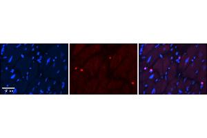 Rabbit Anti-Ppara Antibody  Catalog Number: ARP34068_P050 Formalin Fixed Paraffin Embedded Tissue: Human Adult heart  Observed Staining: Nuclear Primary Antibody Concentration: 1:600 Secondary Antibody: Donkey anti-Rabbit-Cy2/3 Secondary Antibody Concentration: 1:200 Magnification: 20X Exposure Time: 0. (PPARA antibody  (C-Term))