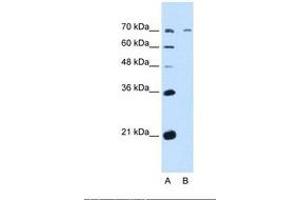 Image no. 2 for anti-UDP-N-Acetyl-alpha-D-Galactosamine:polypeptide N-Acetylgalactosaminyltransferase 6 (GalNAc-T6) (GALNT6) (AA 61-110) antibody (ABIN321163) (GALNT6 antibody  (AA 61-110))