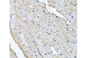 Immunohistochemistry of paraffin-embedded Rat heart using USH1C Polyclonal Antibody at dilution of 1:100 (40x lens). (USH1C antibody)