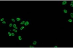 Anti-TP53 mouse monoclonal antibody (ABIN2454590) immunofluorescent staining of COS7 cells transiently transfected by pCMV6-ENTRY TP53 (RC200003). (p53 antibody)