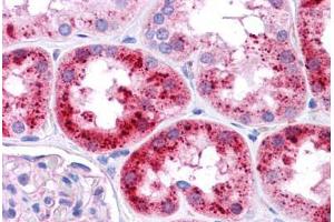 Immunohistochemistry (Formalin-fixed Paraffin-embedded Sections) (IHC (fp)) image for anti-Mucin 1 (MUC1) (AA 38-87) antibody (ABIN6745722)