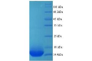 SDS-PAGE (SDS) image for Adrenergic, beta-1-, Receptor (ADRB1) (AA 378-477) protein (His tag) (ABIN5713198)