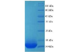 SDS-PAGE (SDS) image for Adrenergic, beta-1-, Receptor (ADRB1) (AA 378-477) protein (His tag) (ABIN4974267)