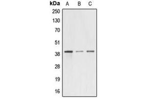 Western blot analysis of A4GNT expression in HEK293T (A), mouse testis (B), rat kidney (C) whole cell lysates. (A4GNT antibody  (Center))