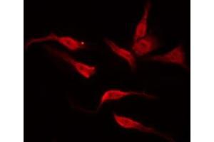 ABIN6276010 staining NIH-3T3 by IF/ICC. (GPR135 antibody  (Internal Region))