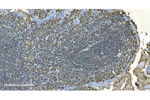 IHC analysis of CD20/MS4A1 using anti-CD20/MS4A1 antibody (ABIN7599233).
