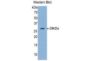 Western Blotting (WB) image for anti-FK506 Binding Protein 8, 38kDa (FKBP8) (AA 93-339) antibody (ABIN1078046) (FKBP8 antibody  (AA 93-339))