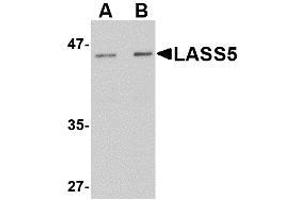 Image no. 1 for anti-LAG1 Homolog, Ceramide Synthase 5 (LASS5) (N-Term) antibody (ABIN342684) (LASS5 antibody  (N-Term))