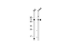 All lanes : Anti-CYP2B6 Antibody (Center) at 1:2000 dilution Lane 1: 293 whole cell lysate Lane 2: Jurkat whole cell lysate Lysates/proteins at 20 μg per lane. (CYP2B6 antibody  (AA 235-263))