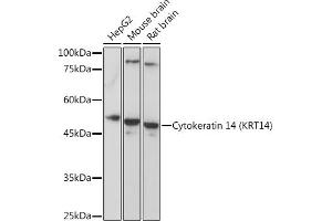 Western blot analysis of extracts of various cell lines, using Cytokeratin 14 (Cytokeratin 14 (KRT14)) Rabbit pAb (ABIN7268092) at 1:5000 dilution. (KRT14 antibody  (C-Term))