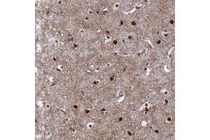 Immunohistochemical staining of human cerebral cortex with RAVER2 polyclonal antibody  shows strong nuclear positivity in neuronal cells and glial cells at 1:50-1:200 dilution. (RAVER2 antibody)
