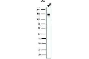 Western Blot Analysis of human Raji cell lysate using CD22 Mouse Monoclonal Antibody (BLCAM/1796). (CD22 antibody  (AA 52-178))
