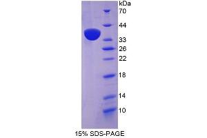 Image no. 1 for Spectrin Repeat Containing, Nuclear Envelope 2 (SYNE2) (AA 6-296) protein (His tag) (ABIN4990488) (SYNE2 Protein (AA 6-296) (His tag))