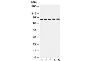 Western blot testing of 1) rat brain, 2) rat testis, 3) human SGC-7901, 4) 22RV1 and 5) MCF7 lysate with APLP1 antibody. (APLP1 antibody)