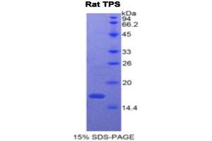 SDS-PAGE (SDS) image for Tryptase alpha/beta 1 (TPSAB1) (AA 149-273) protein (His tag) (ABIN2122280)