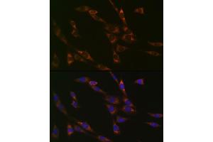 Immunofluorescence analysis of NIH-3T3 cells using RPS3 Rabbit mAb (ABIN7270025) at dilution of 1:100 (40x lens). (RPS3 antibody)