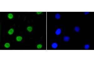 A549 cells were stained with Nrf2(S40) (7G4) Monoclonal Antibody  at [1:200] incubated overnight at 4C, followed by secondary antibody incubation, DAPI staining of the nuclei and detection. (NRF2 antibody  (pSer40))